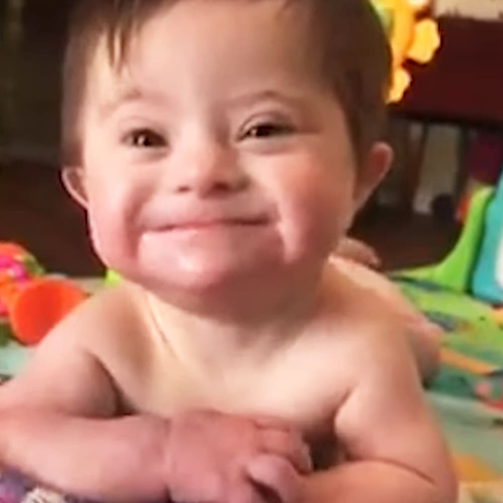 Baby with down syndrome